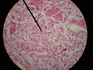 Adrenal Gland at 400x Magnification