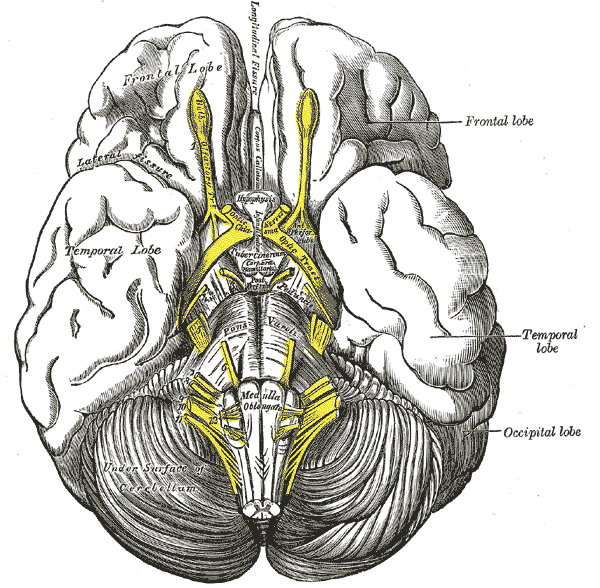 Transient global amnesia - Wikipedia