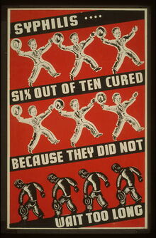 Syphilis-poster-wpa-cure