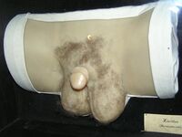 Wax human hermaphrodit genital 1