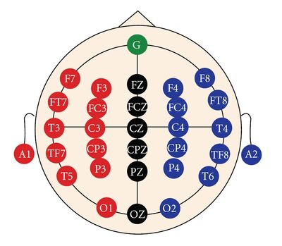 Схема наложения электродов при ээг