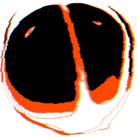 Second Image