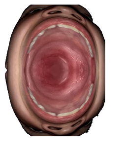 Strasno.png