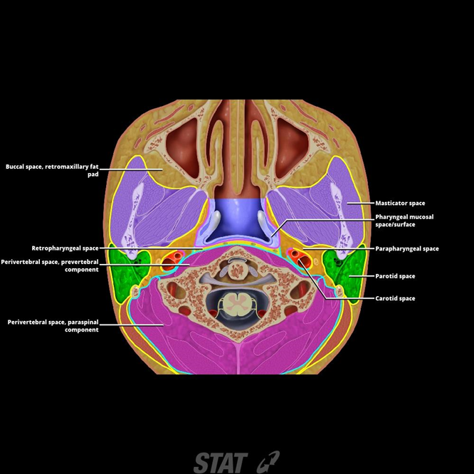 parapharyngeal space