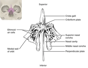Nasal Cavity Paranasal Sinuses Bones Foramina Canals Ethmoid Bone Ranzcrpart1 Wiki Fandom