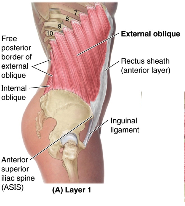 Abdomen:Muscles:Anterolateral abdominal muscles and aponeuroses, RANZCRPart1 Wiki