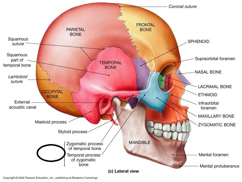 zygomatic area