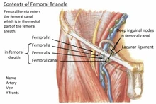 Ligaments Hip Inguinal Ligament Ranzcrpart1 Wiki Fandom