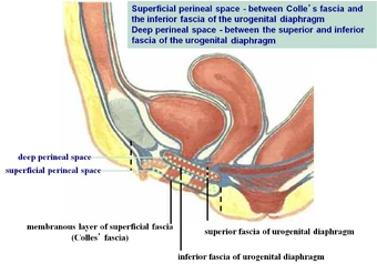 Radiological Spaces And Foramina Pelvis Superficial And Deep Perineal Pouches Ranzcrpart1 Wiki Fandom Questions on anatomy of urogenital triangle, superficial and deep perineal pouches, pudendal nerve, internal pudendal artery, perineal body and 8 name the structures that pierce perineal membrane in males and females. radiological spaces and foramina pelvis