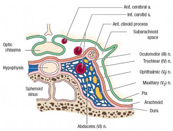 sphenoid sinus and cavernous sinus