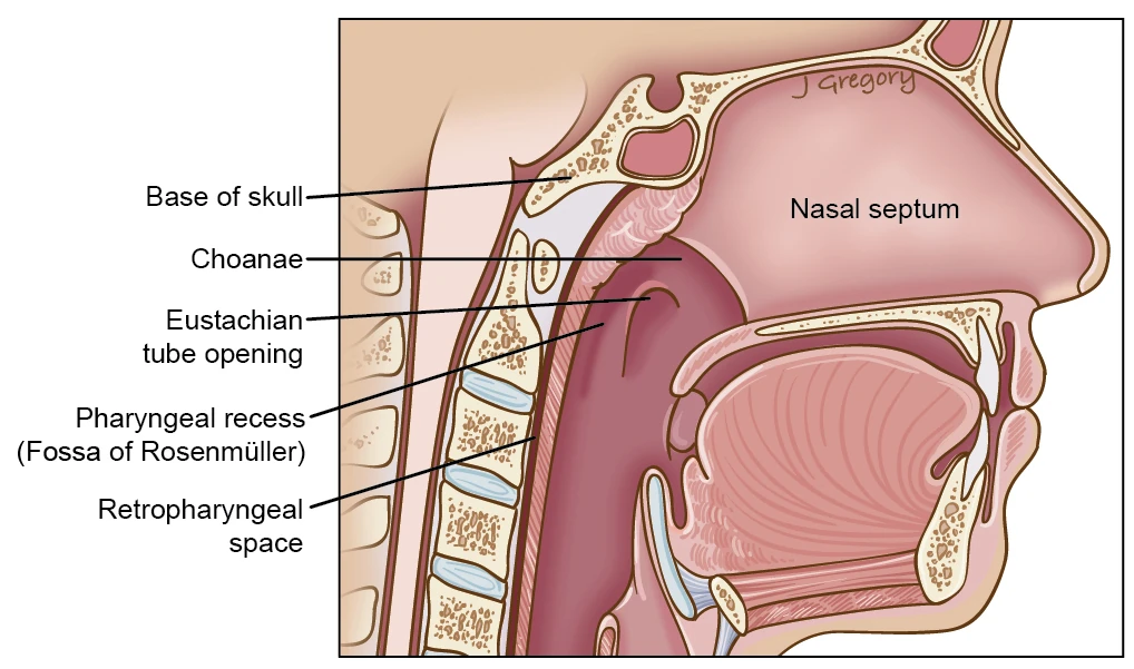 Nasopharynx Rosenmuller Fossa Ranzcrpart1 Wiki Fandom