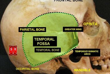 Infratemporal fossa:Mandibular n. & branches, RANZCRPart1 Wiki