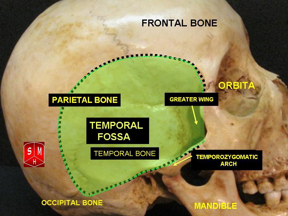 Regions anterior:Anatomical snuff box:Boundaries, RANZCRPart1 Wiki