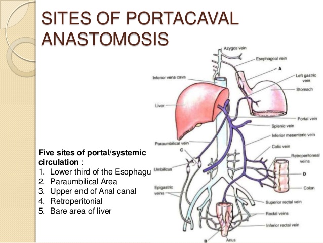 portal hypertension collaterals