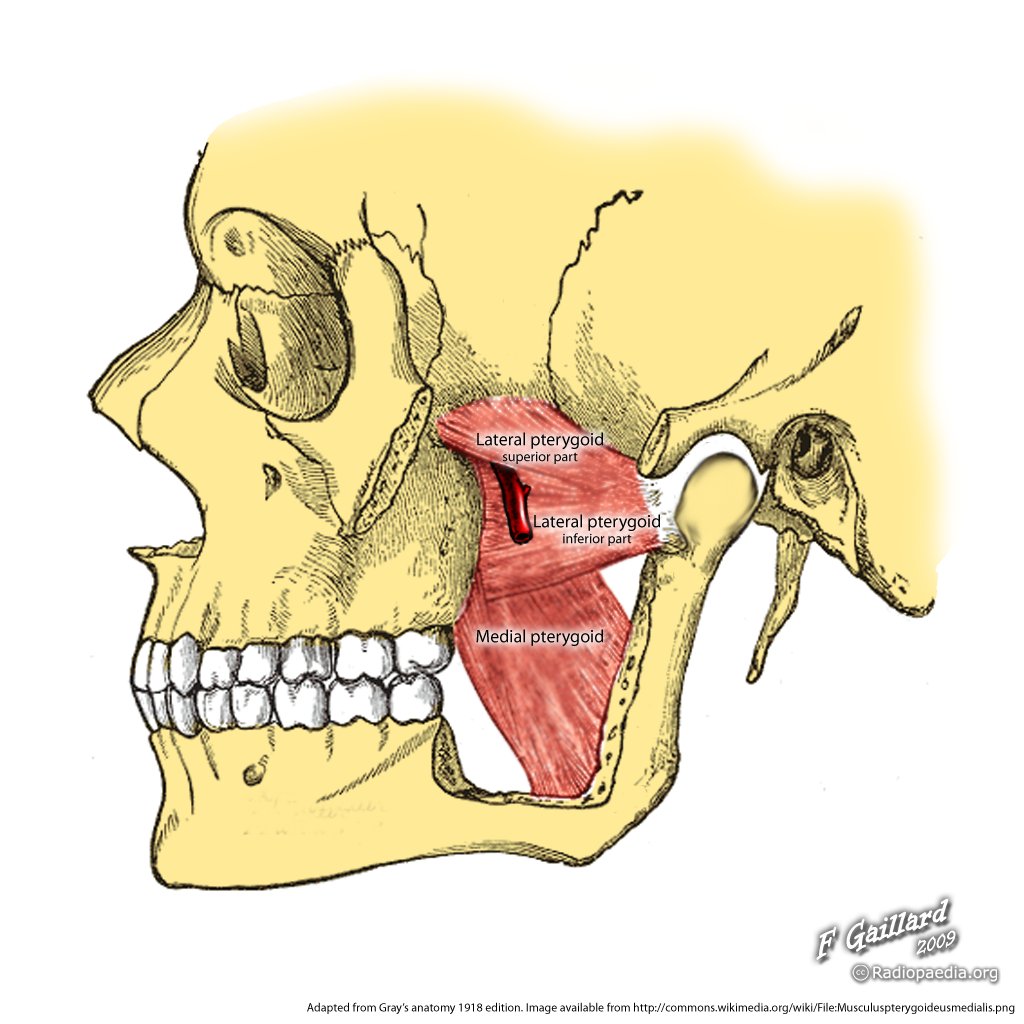 Infratemporal fossa:Mandibular n. & branches, RANZCRPart1 Wiki