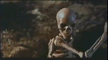 Living Skeleton.png