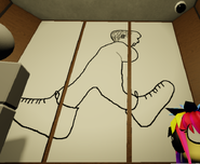 A baby with an abnormal body wearing shoes.