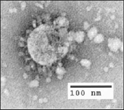 SARS-CoV-1 under electron microscope