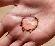 Man Touches Mysterious Squid, Burns Eternally Sizzling Circle Into Hand