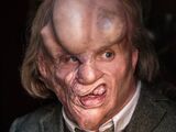 Joseph Merrick