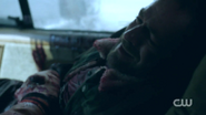 RD-Caps-2x01-A-Kiss-Before-Dying-09-Fred-bleeding.png (722 KB)