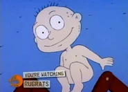 "He won't keep it on!"