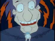 "Crossbite?"
