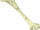 Bone club