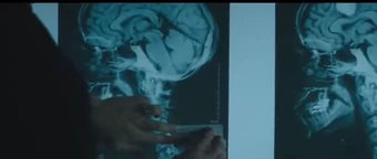 Logan mislabels the X-Rays