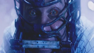 Fitch is electrocuted