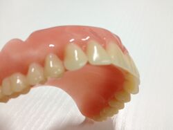 Zahnprothese