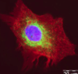 Lysosomes.png