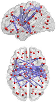 Brain network