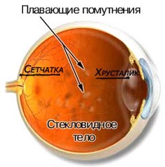 Стекловидное тело | Наука | Fandom
