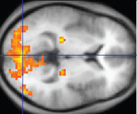 1206 FMRI