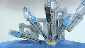 Robotic-Surgery-01a-goog