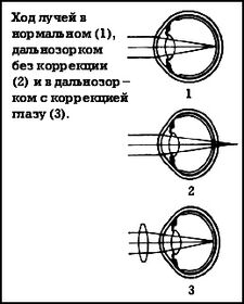 Bol 2+