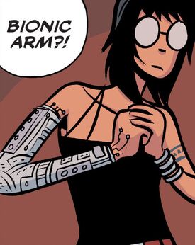 Vol-3-Bionic-Arm