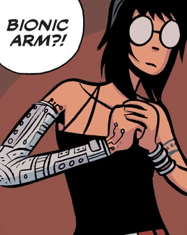 Vol-3-bionic-arm