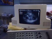 5x18-Gay Baby Turk.jpg