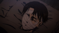 Levi's bandaged face