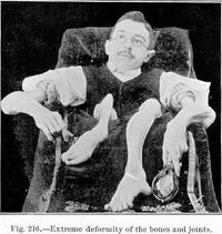 Count orloff2