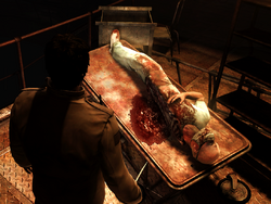 Alex encounters a horizontally-severed corpse, appearing to be his father dressed as a surgeon, in his nigtmare.