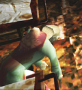 Parasite on the nurse's back.