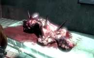 A dead Wall Corpse lying bled out on an operating table.