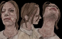 Обезображенное болезнью лицо Мэри