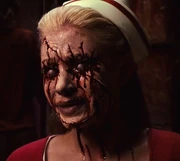 Lisa con los ojos heridos como resultado de su curiosidad.