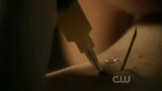 the bent injection needle