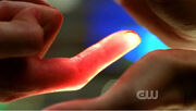 Chloe heals Jimmy's finger.