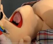 Coma